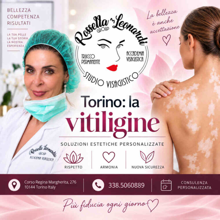 Vitiligine Torino.1000 Vitiligine Torino