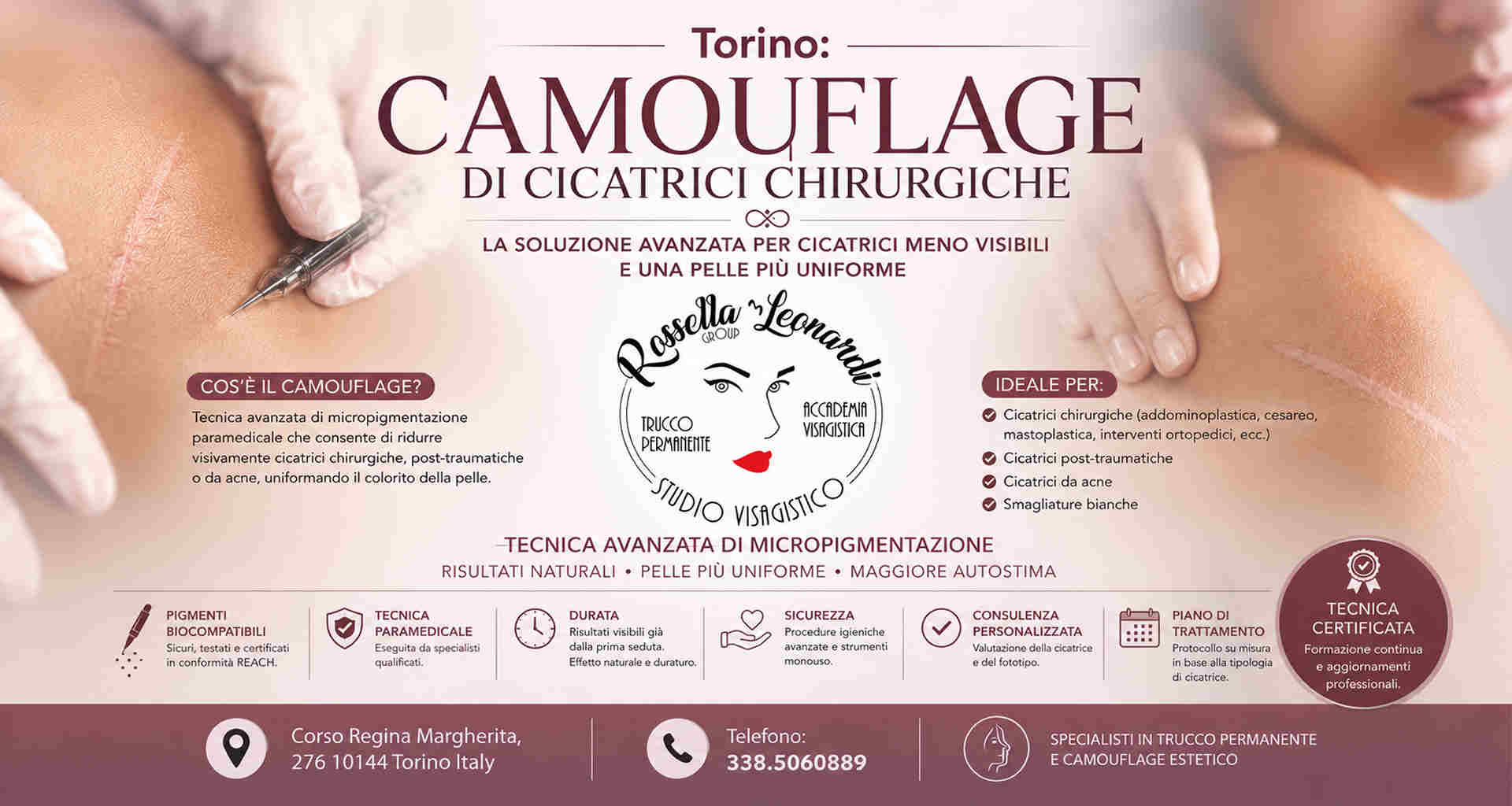 dermopigmentazione cicatrici Torino dermopigmentazione cicatrici Torino