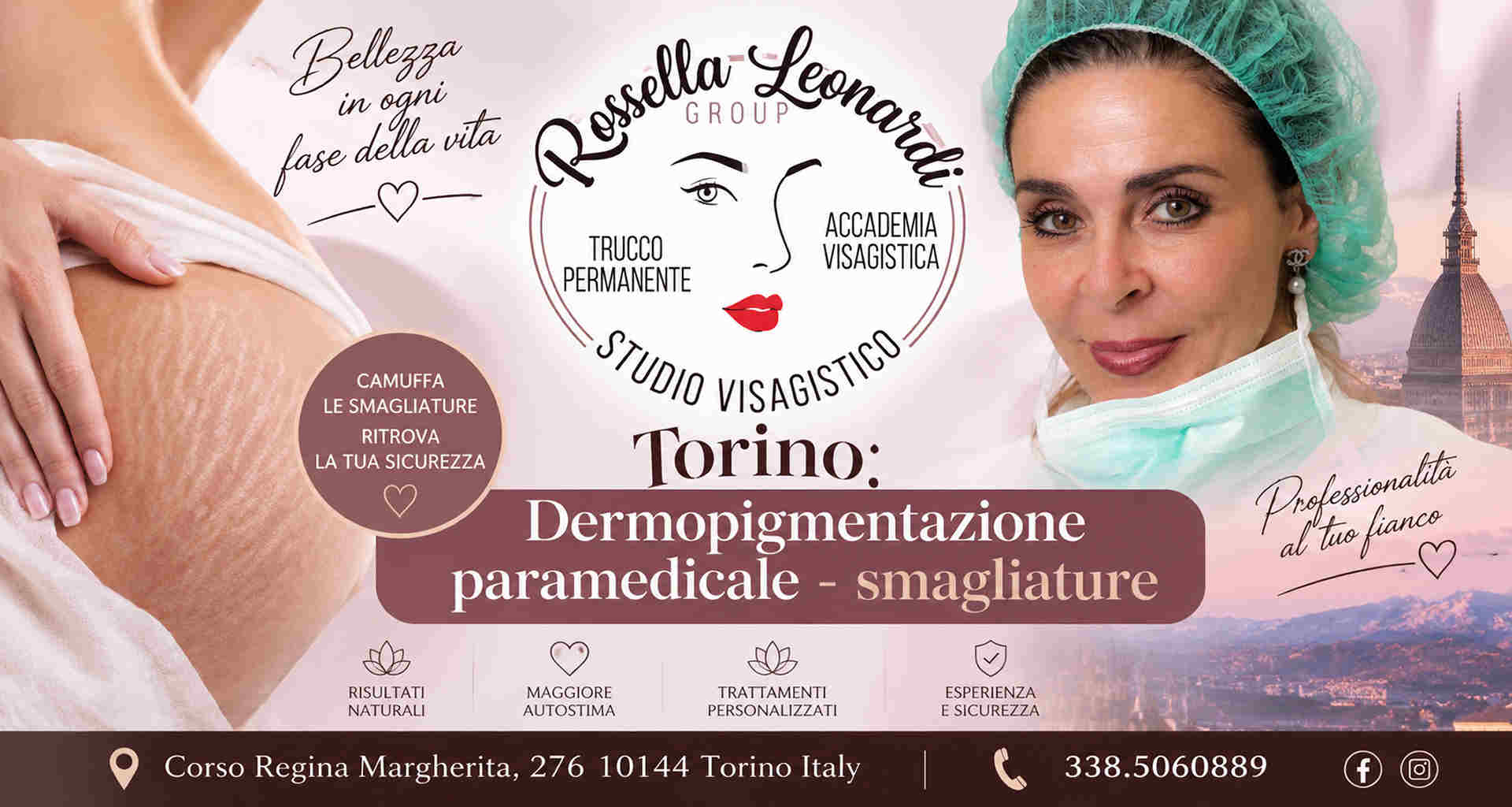 smagliature torino smagliature torino